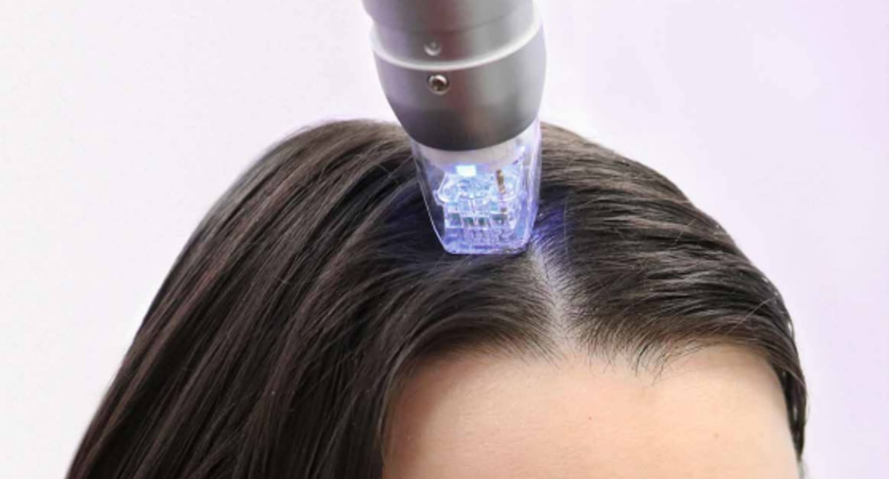 Комплексная терапия волосистой части головы
